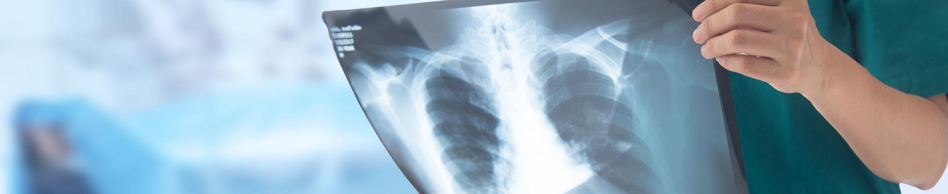 What is Pulmonary Fibrosis?